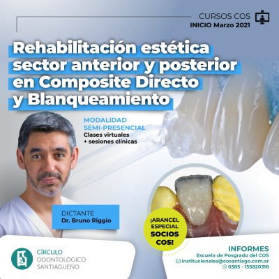 Rehabilitación Estética sector anterior y posterior en composite directo y Blanqueamiento